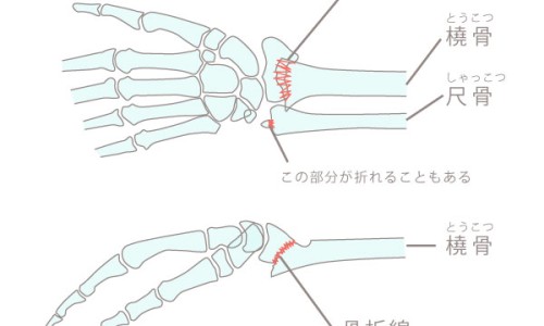 便隐血和便潜血一样吗、便潜血查的是尿还是屎 -便隐血和潜血的区别网